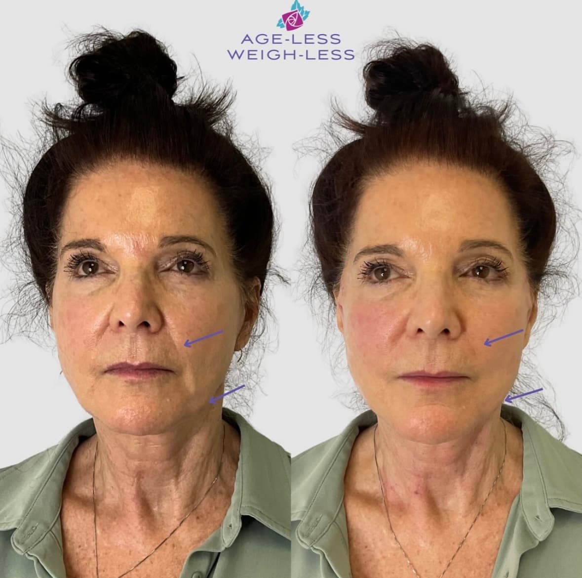 Age-less Weigh-less
