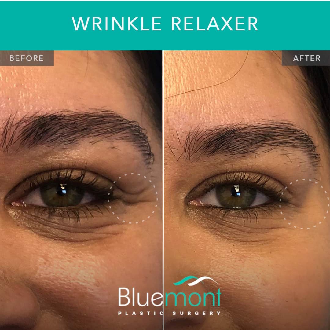 Bluemont Plastic Surgery