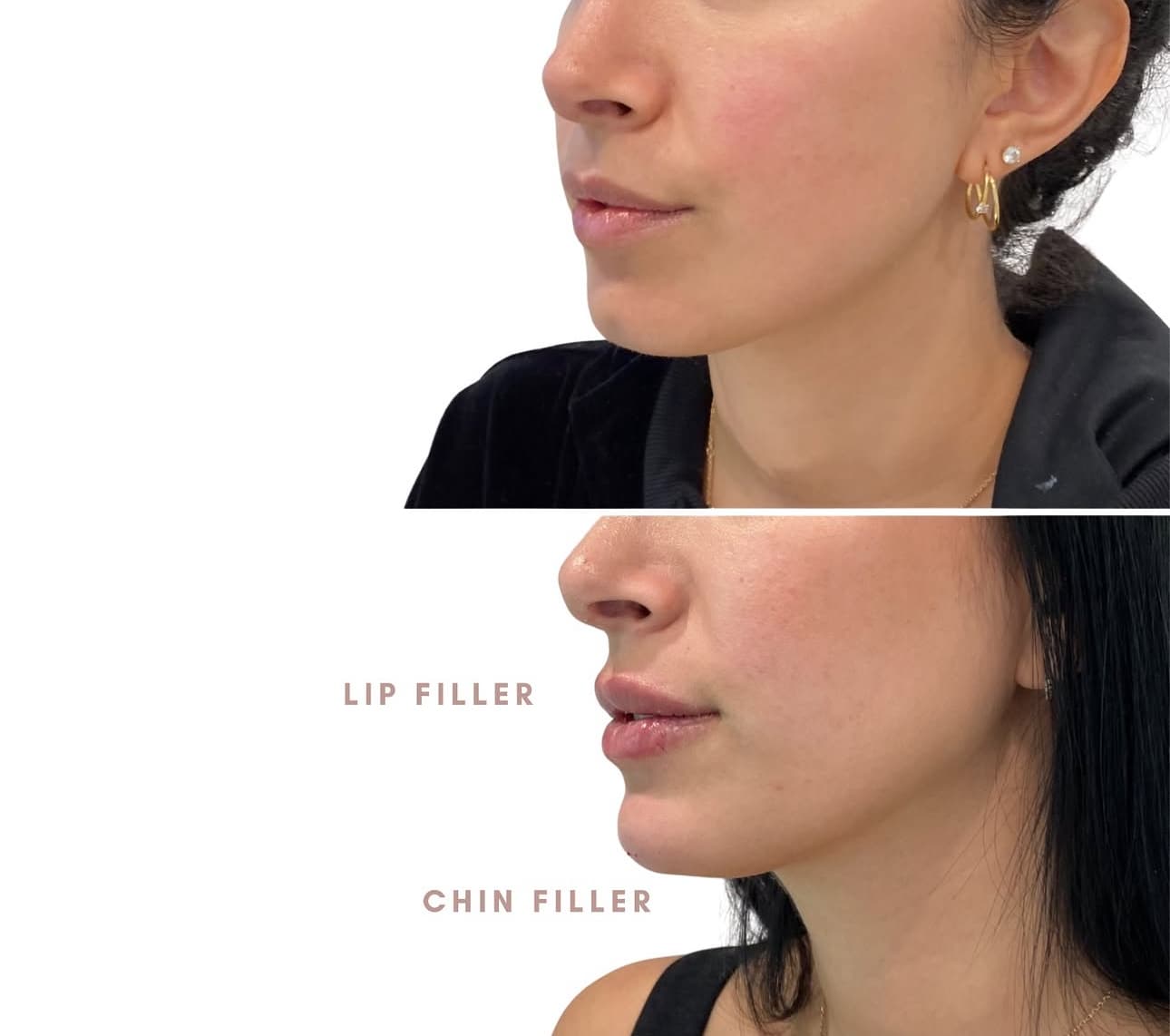 Vanity Look Skin Center