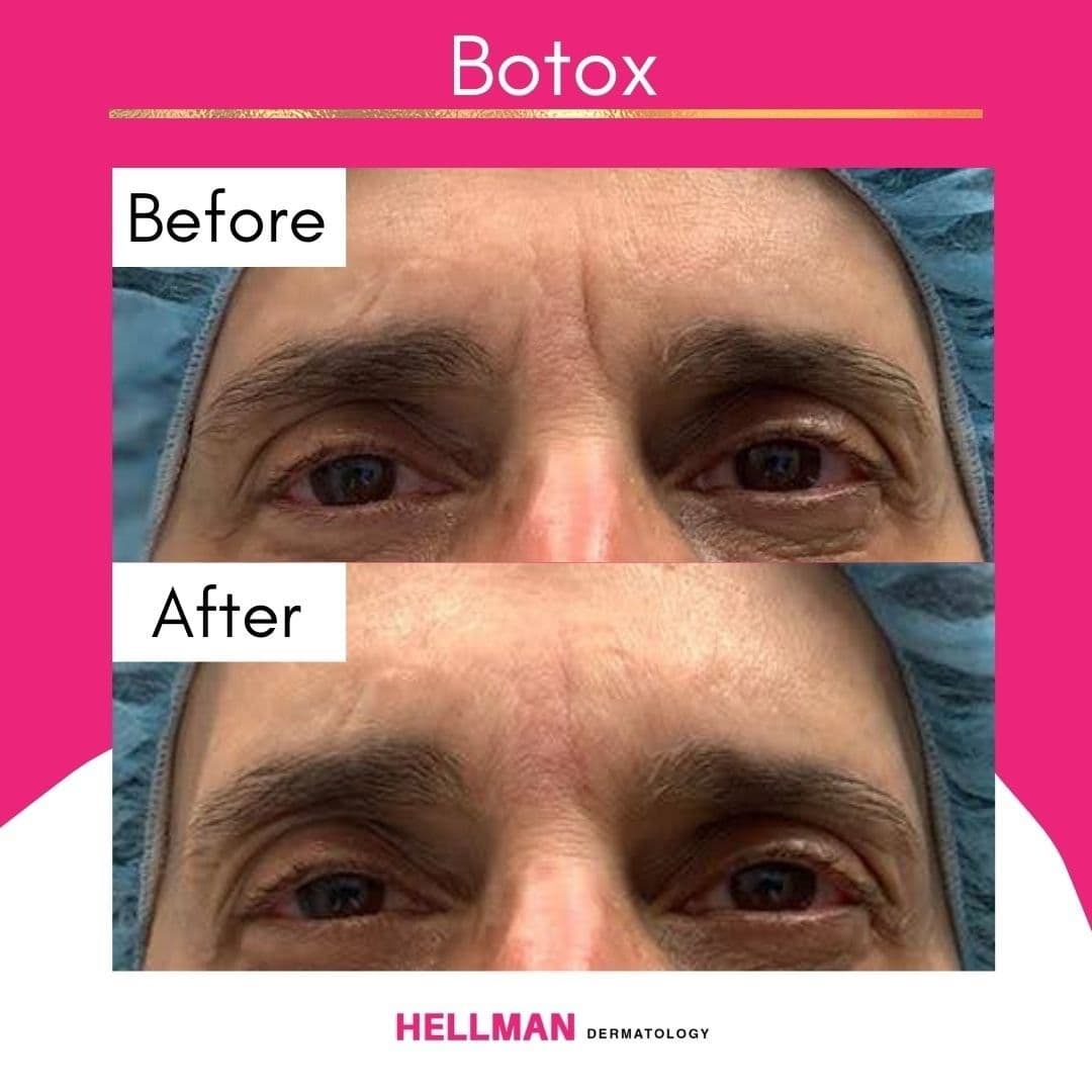 Dr. Judith Hellman, M.D. - Hellman Dermatology photo 1 of 8