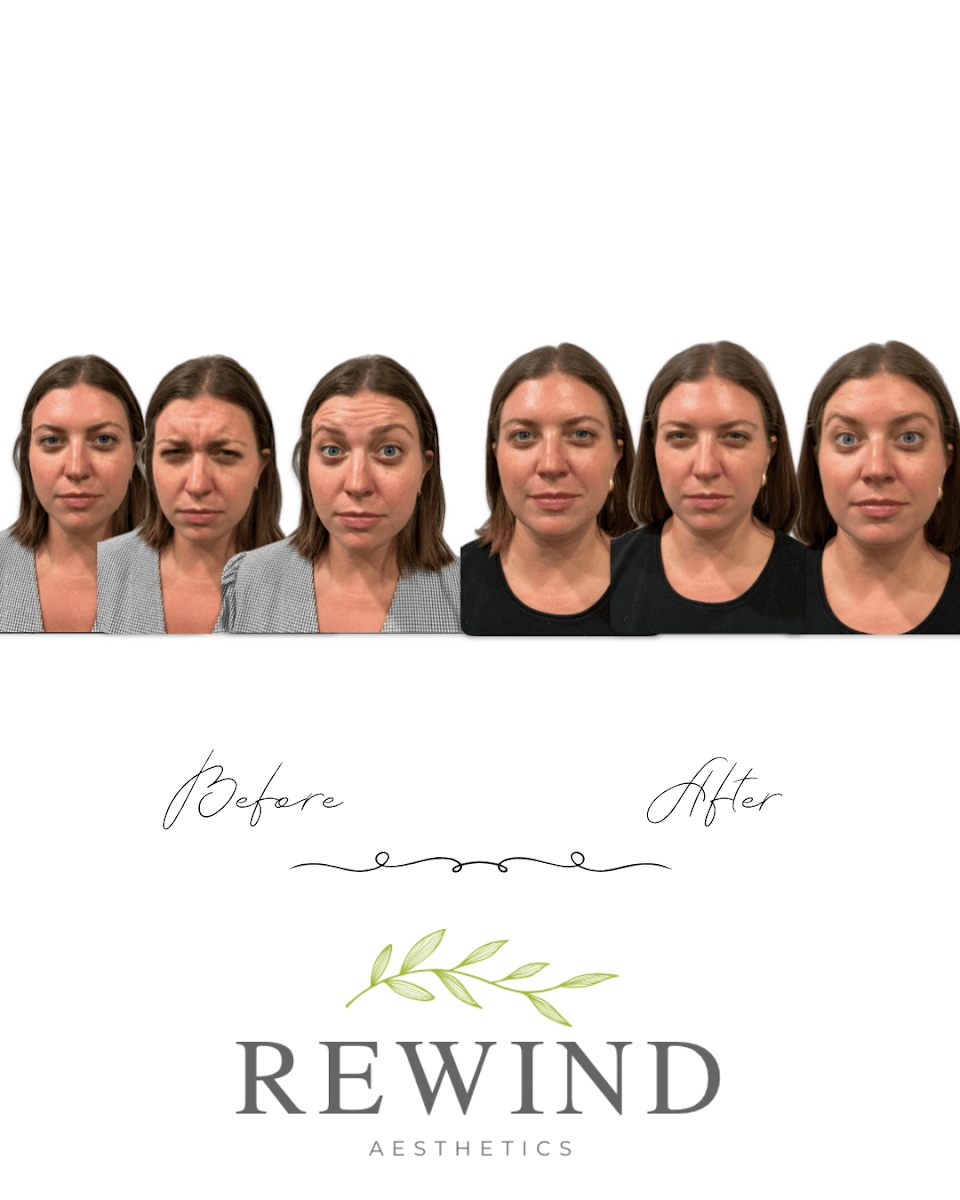 Rewind Aesthetics photo 1 of 7