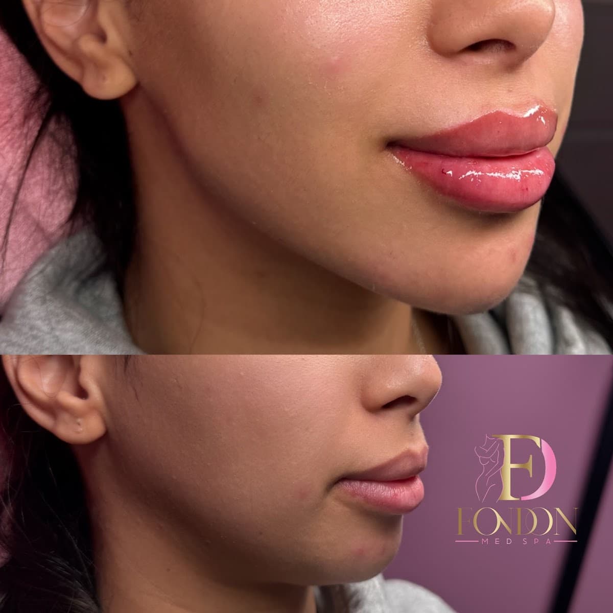 Fondon Medspa photo 1 of 8