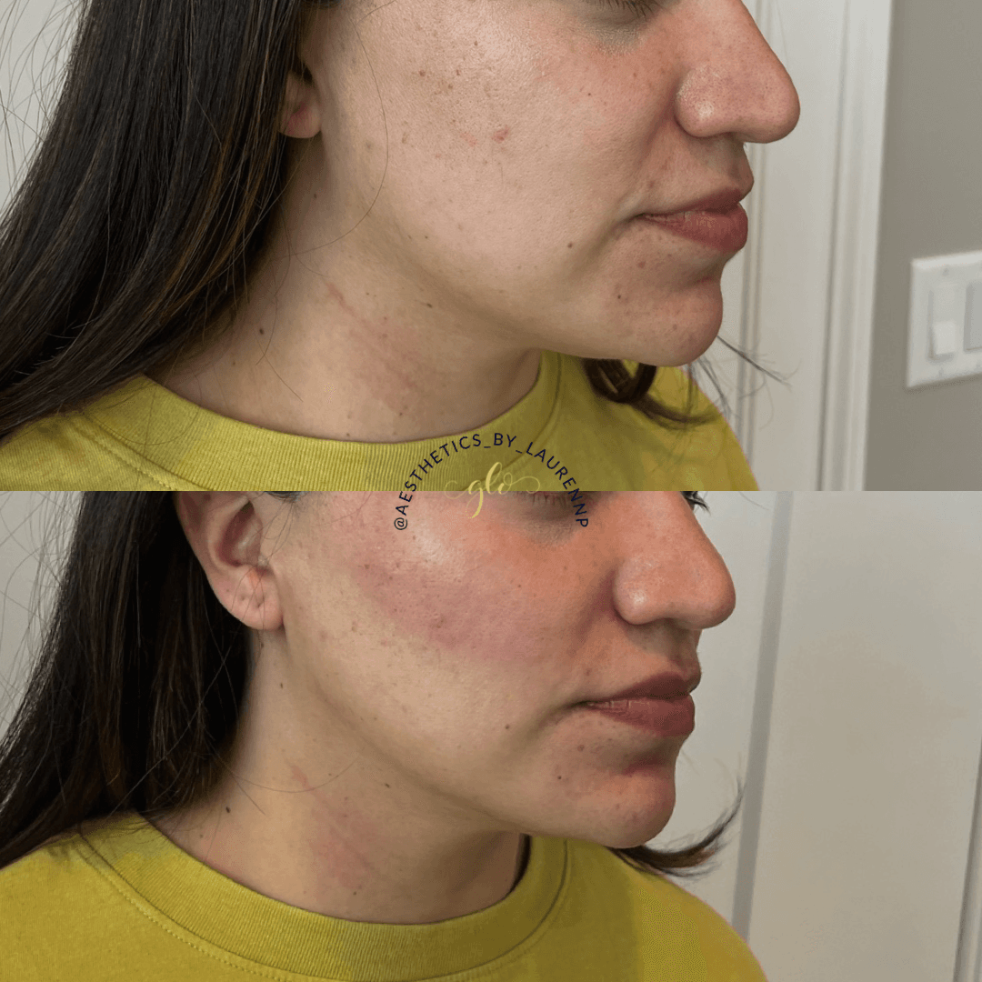 Glo Esthetics photo 1 of 8