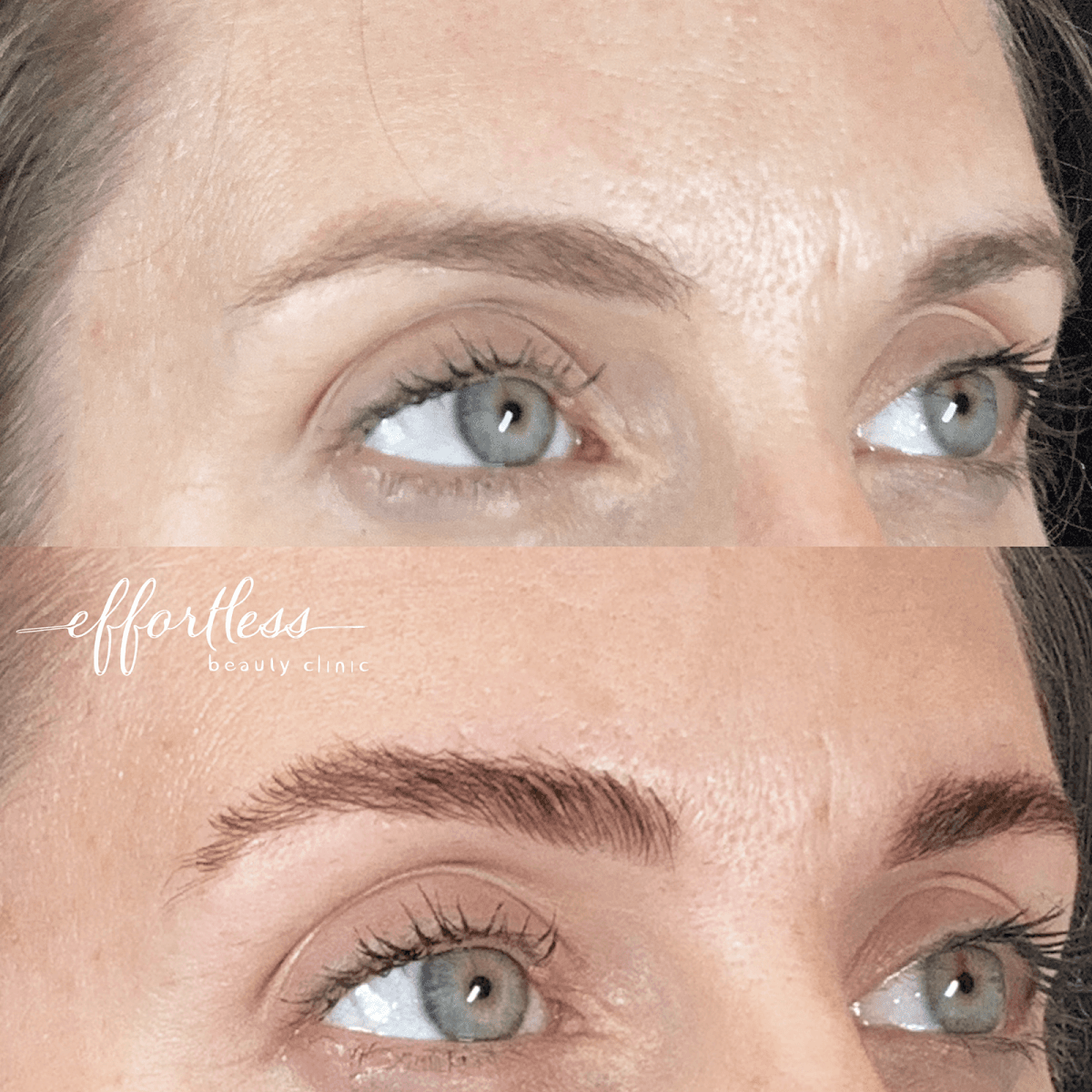 Effortless Beauty Clinic | North Austin | Facials, Lashes, Brows