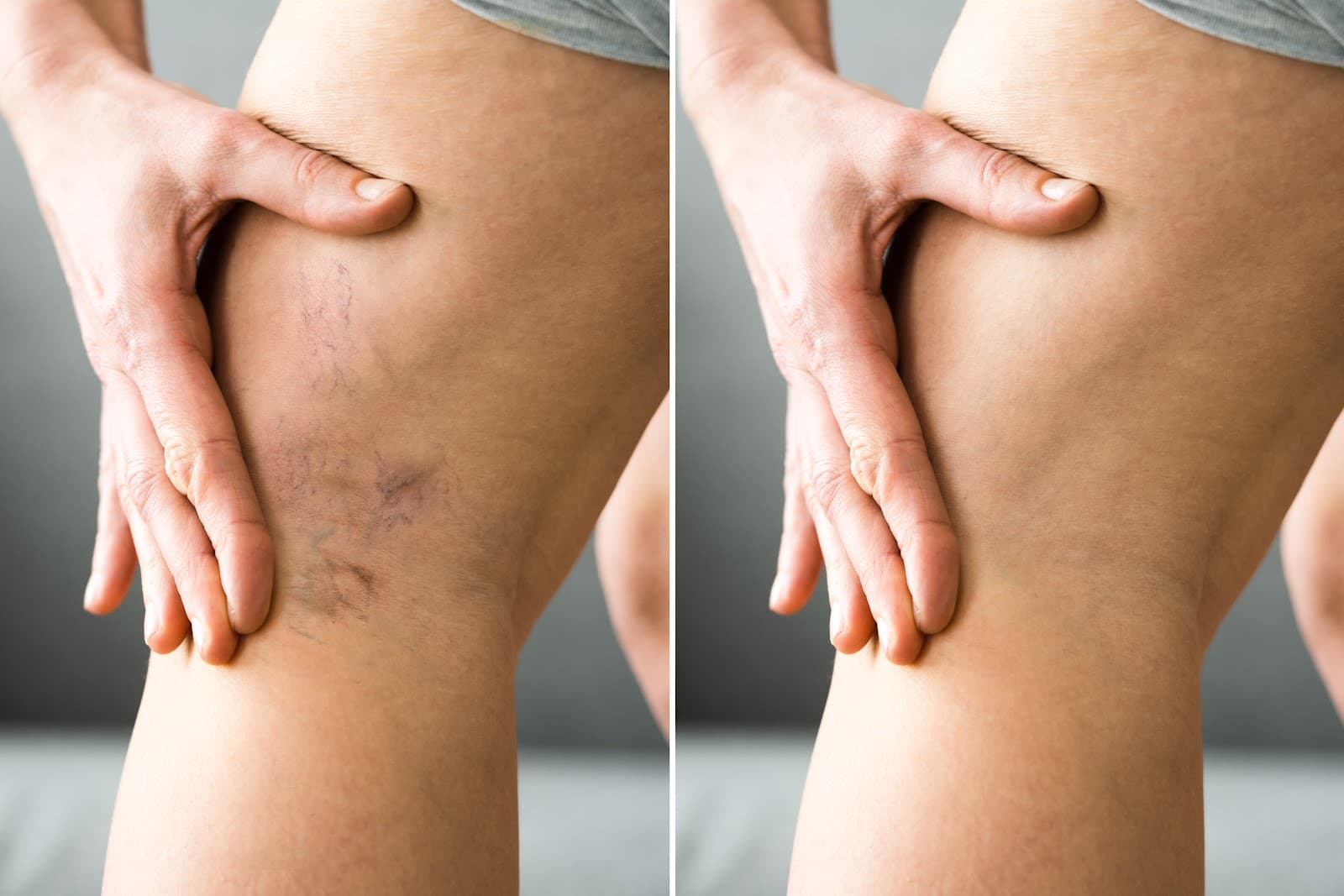 Charming Skin Vein Clinics photo 1 of 8
