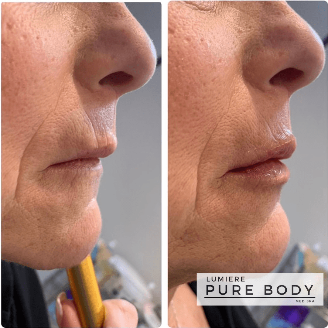 Lumiere Pure Body Med Spa Bucks County