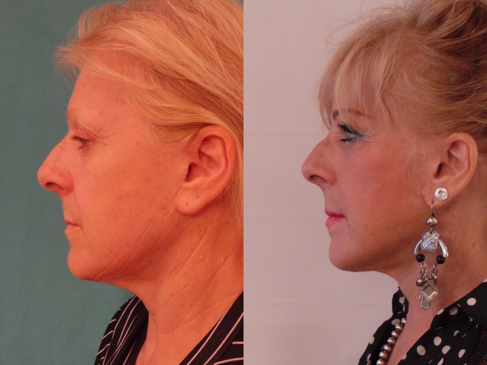 Artful Awakenings Cosmetic Surgery Center