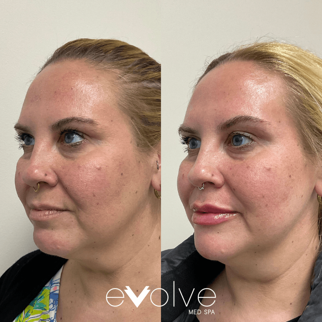 Evolve Med Spa