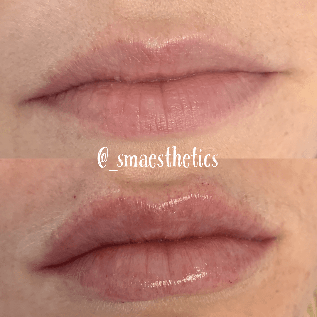 SM Aesthetics