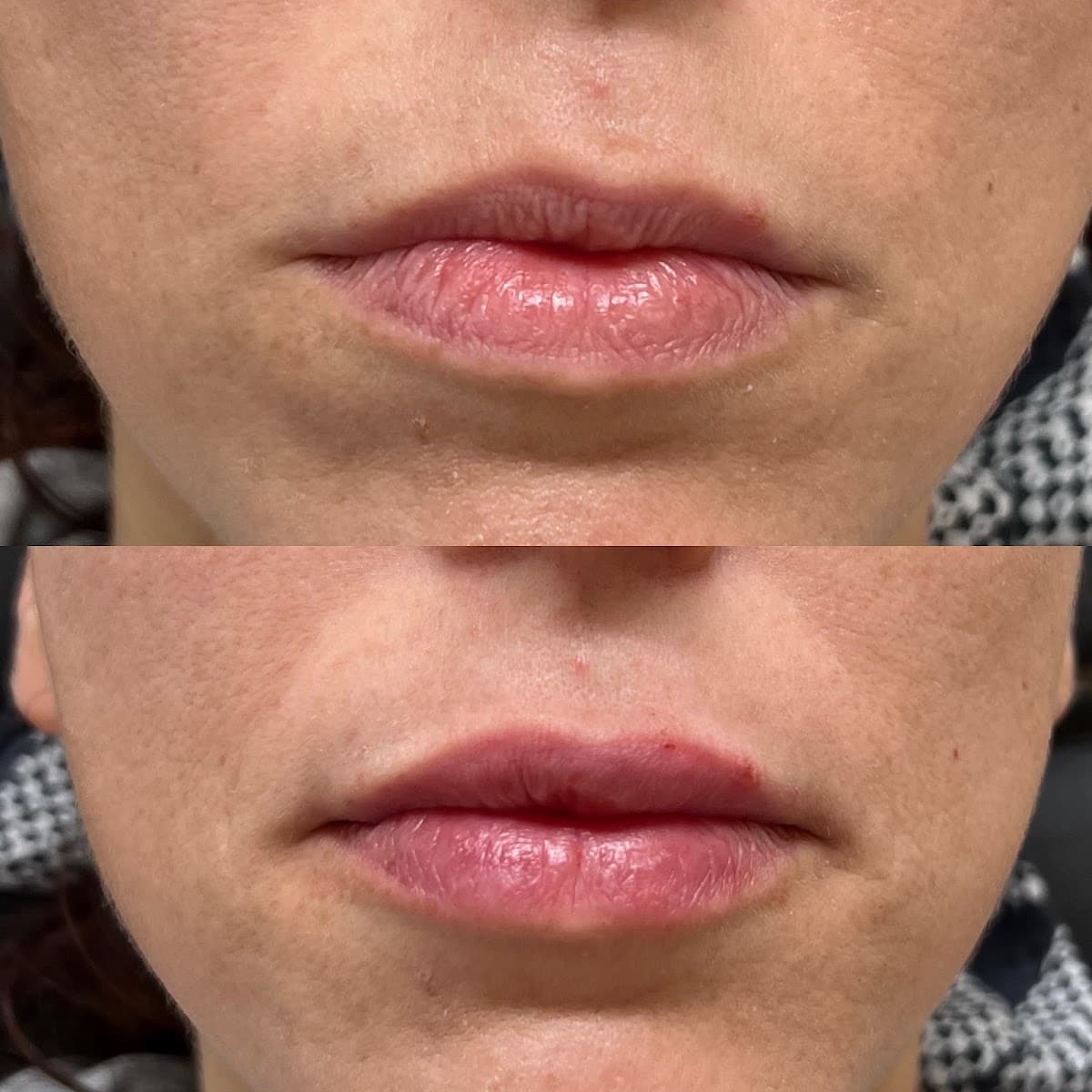 Sandy Lanier, PA-C, Austin's Expert Injector in Biostimulators, Filler and Botox photo 1 of 8