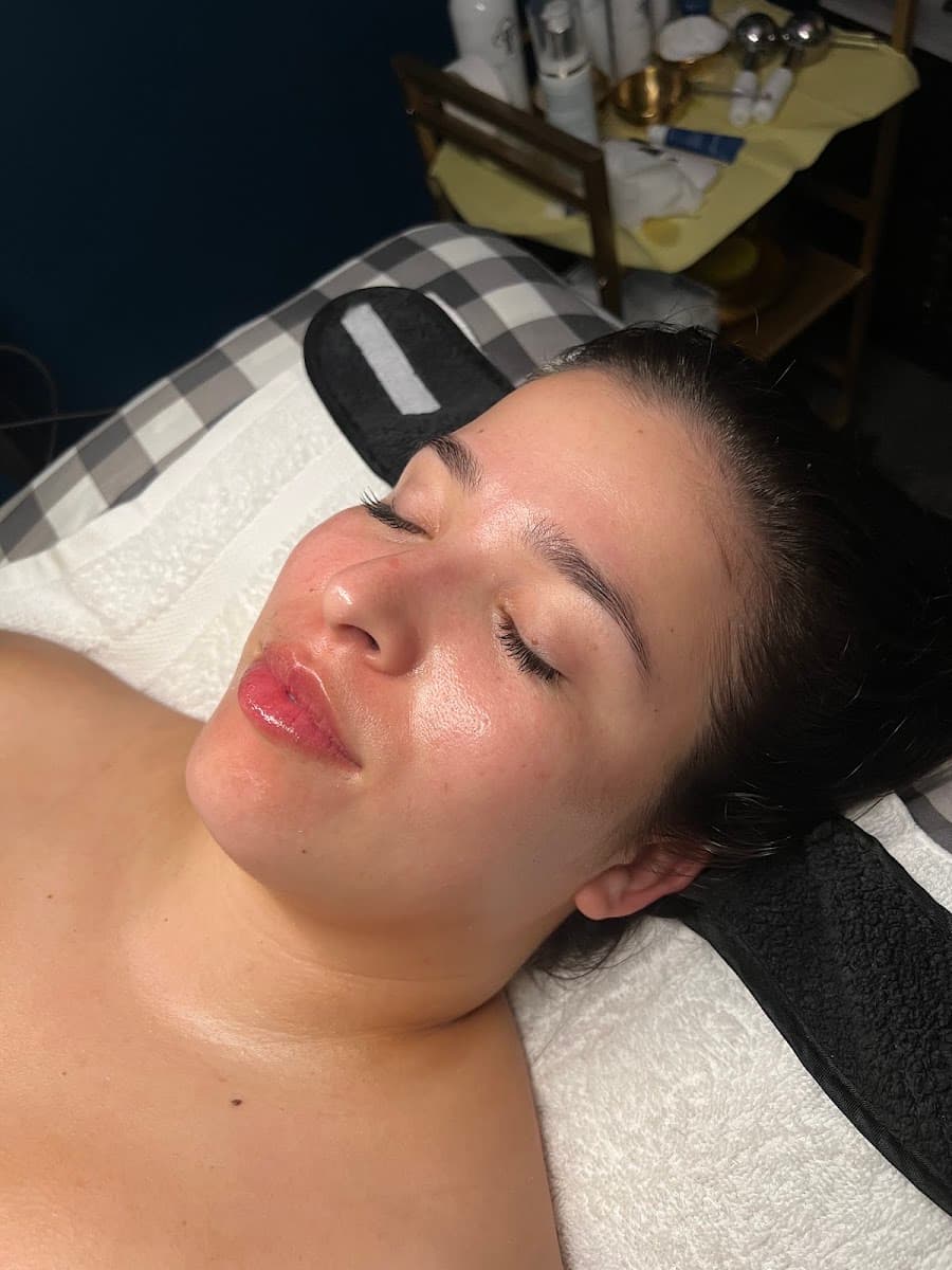 Freckles Skincare