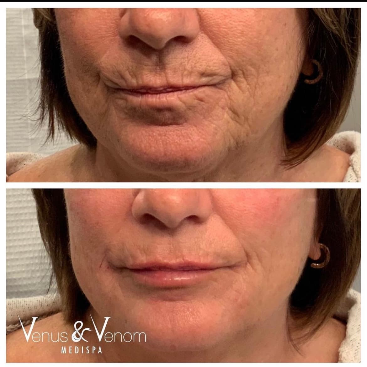 Venus & Venom MEDIspa Monroe photo 1 of 8