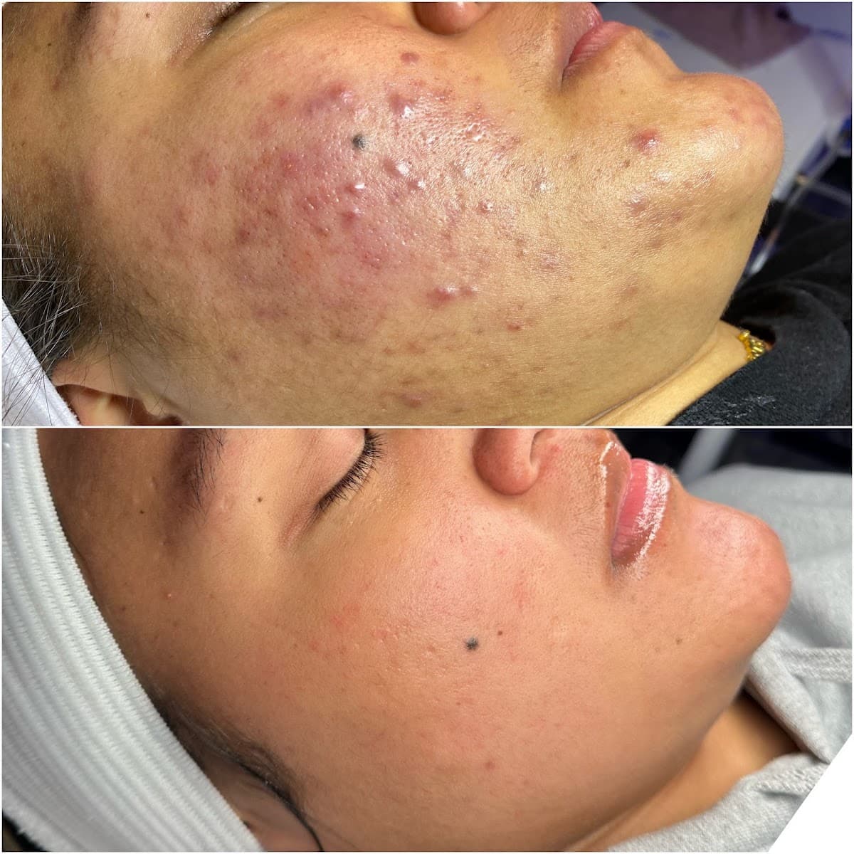 Skincare By Chanel