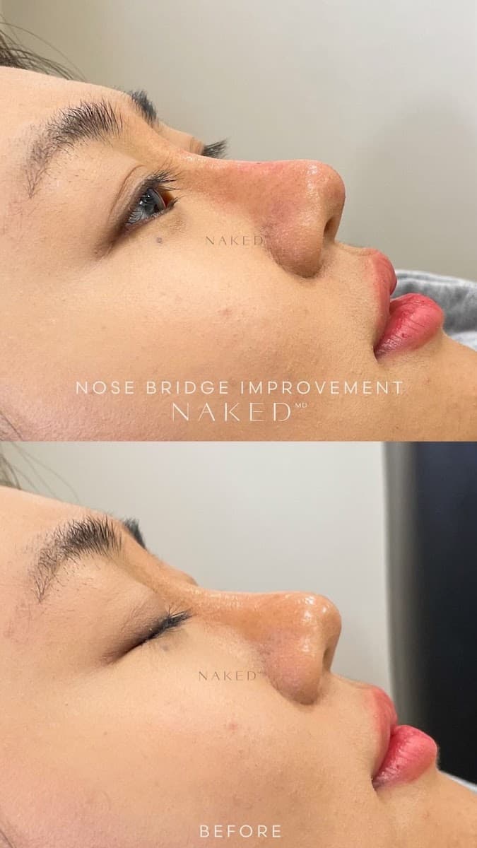 NakedMD Med Spa Chula Vista