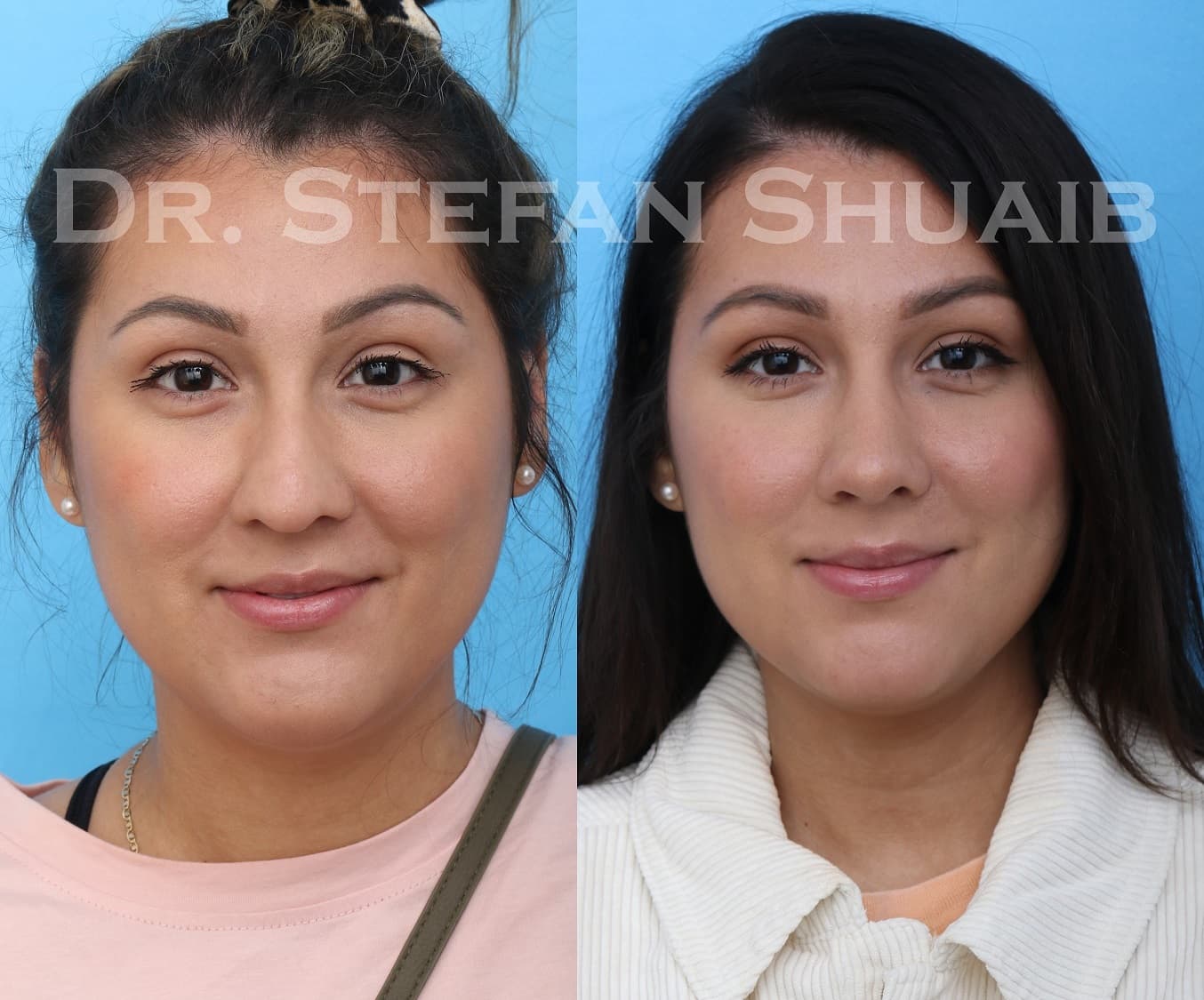 Dallas Facial Plastic Surgery Center