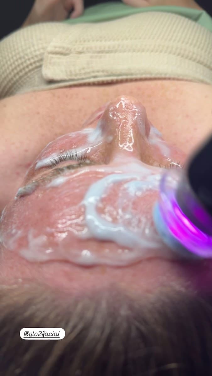 Skin Confidence photo 1 of 6