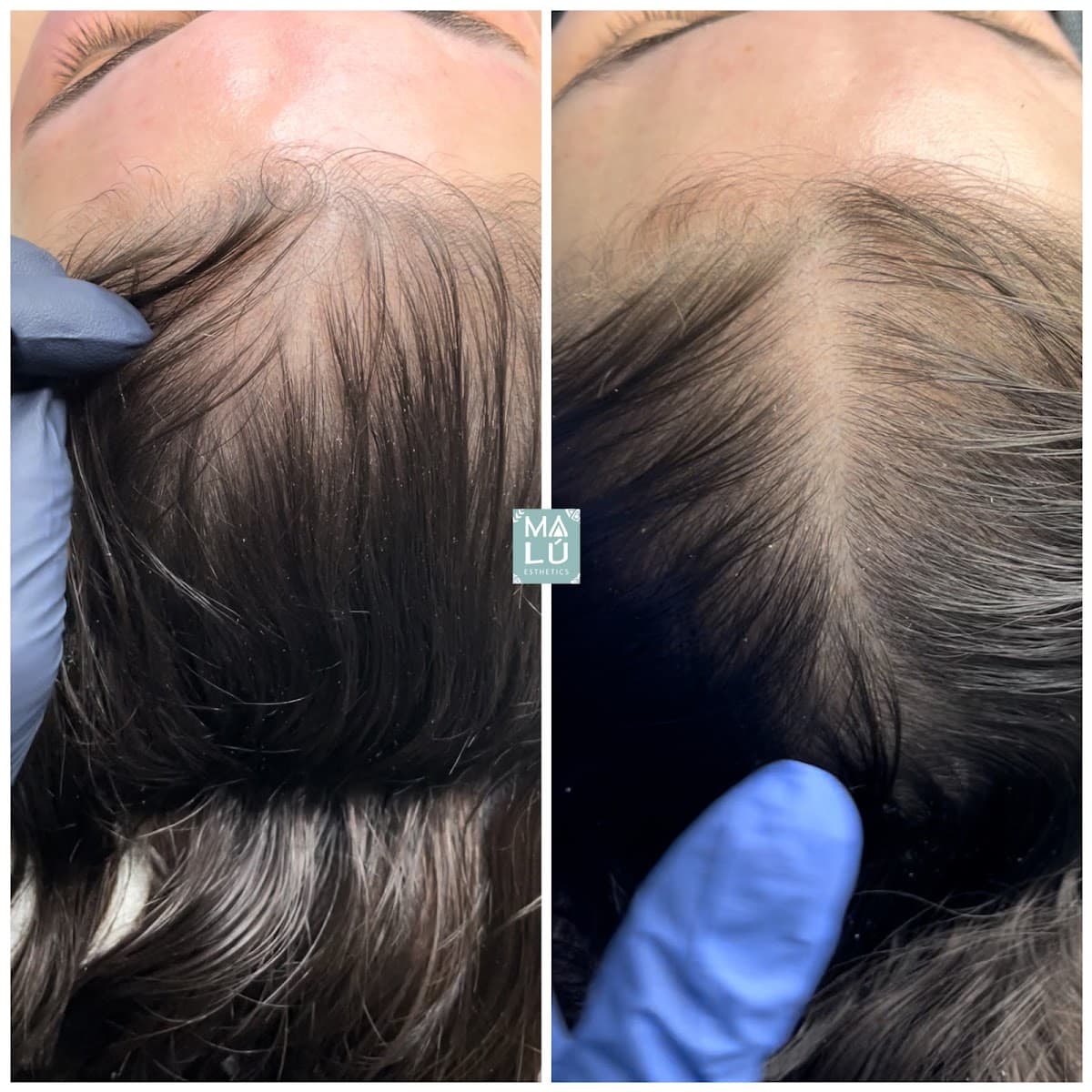 Malú Esthetics Corrective Skincare - Acne Specialist - Procell therapies Provider photo 1 of 8