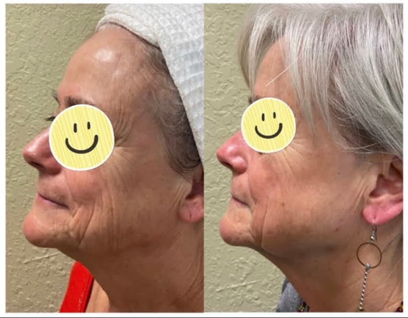 Vibrant Aesthetics at iSpa Health Studios