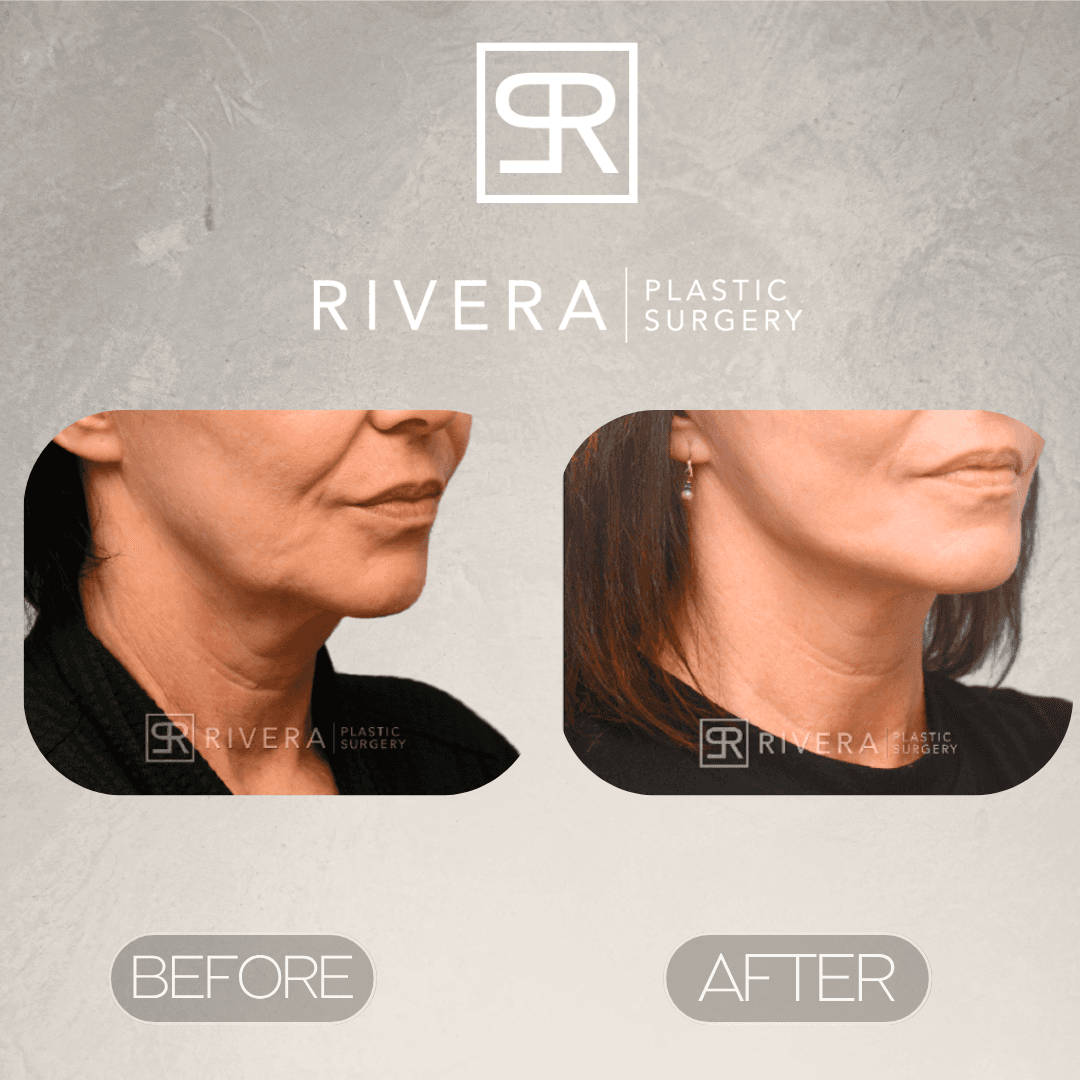 Rivera Plastic Surgery photo 1 of 6