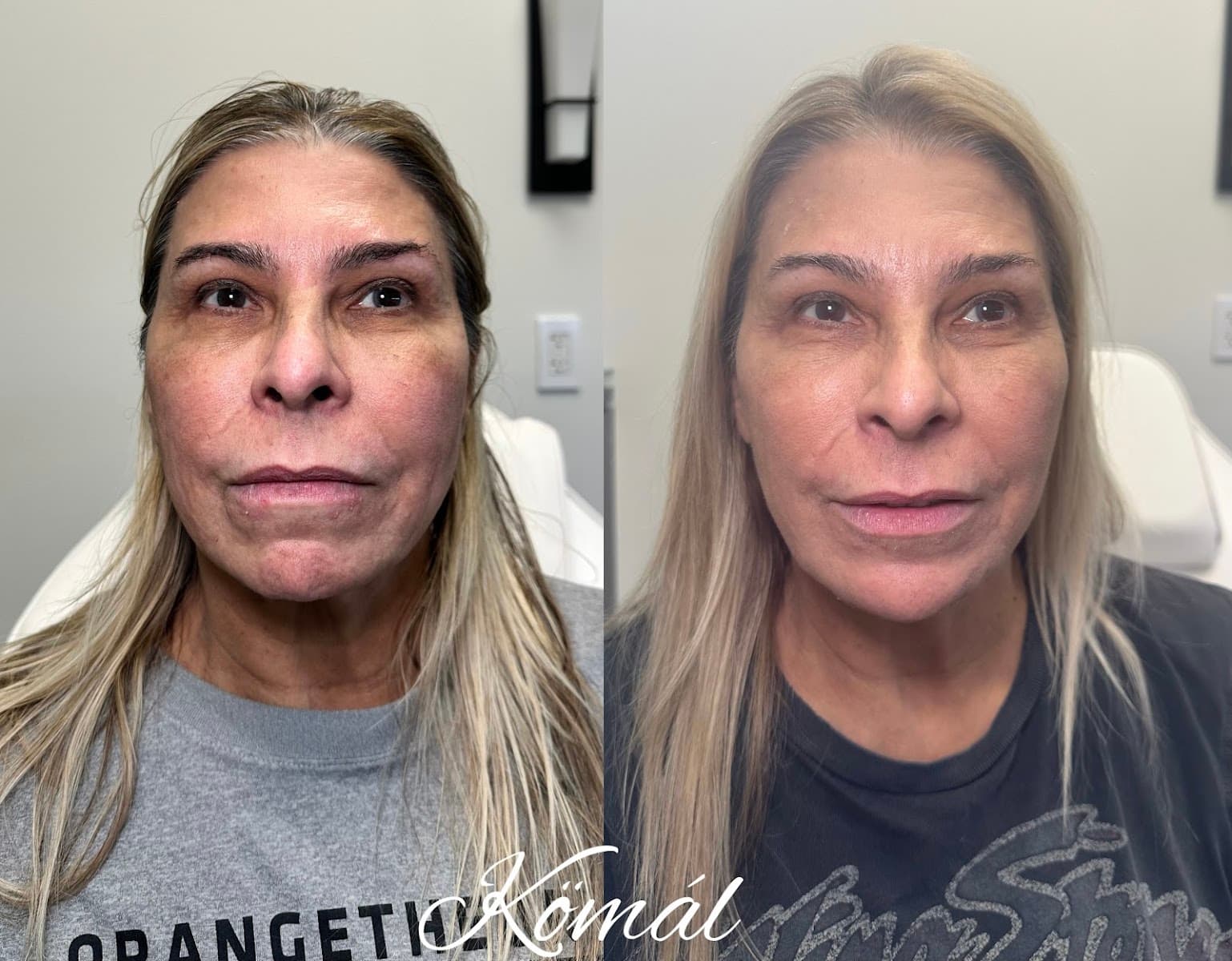 Komal Aesthetics & Wellness