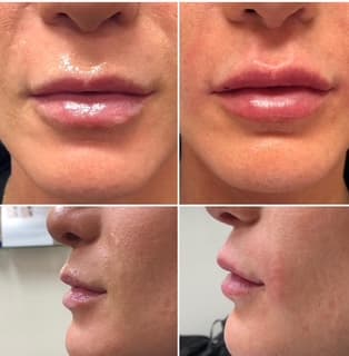 Refine Med Spa