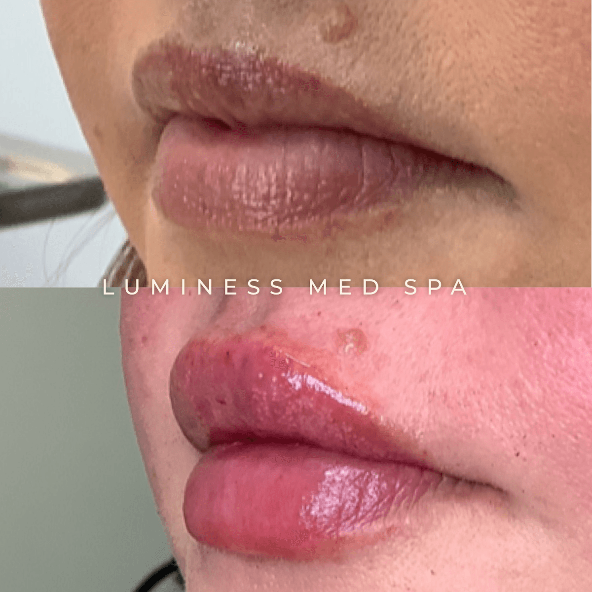 Luminess Med Spa