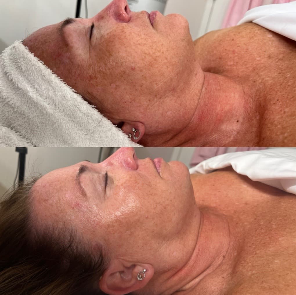 Simply Skin Studio, LLC photo 1 of 7