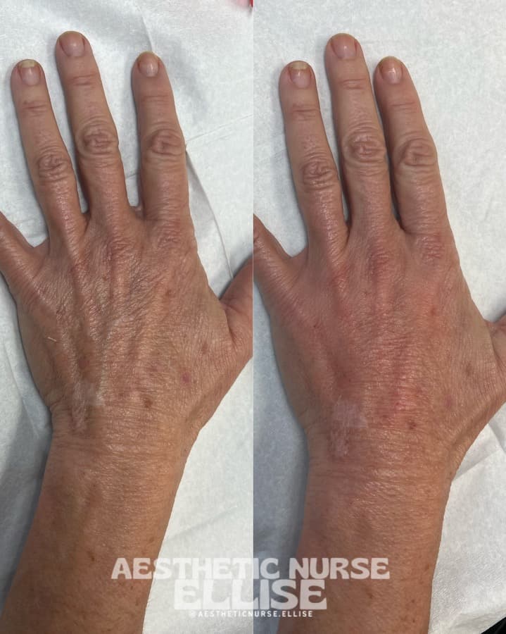 Proven Aesthetics Med Spa