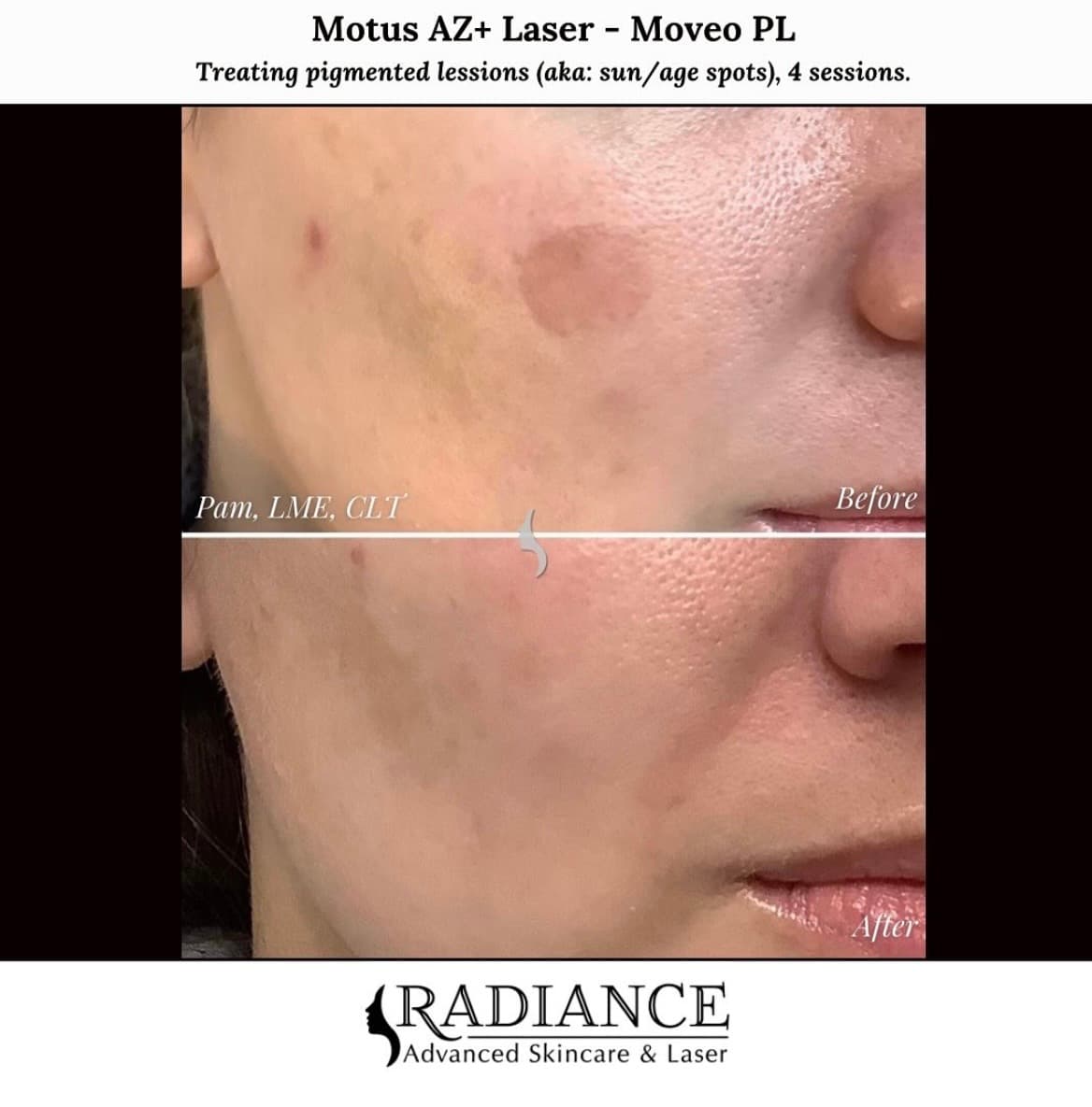 Radiance Advanced Skincare & Laser photo 1 of 8