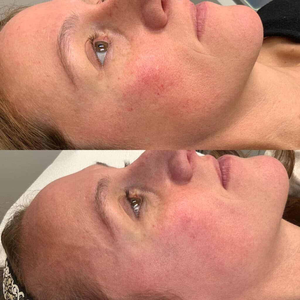 Elite Dermatology & Plastic Surgery