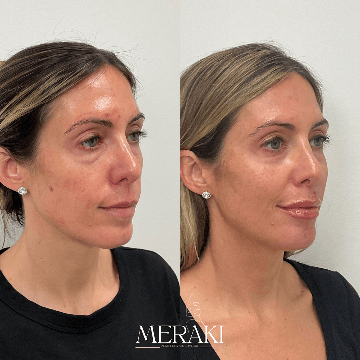 Meraki Aesthetics and Wellness
