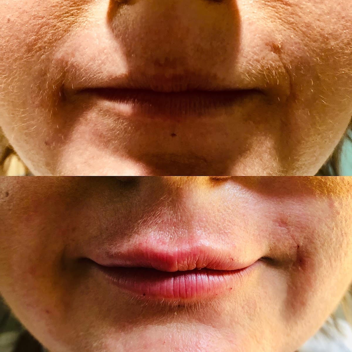 Great Lakes Medical Spa