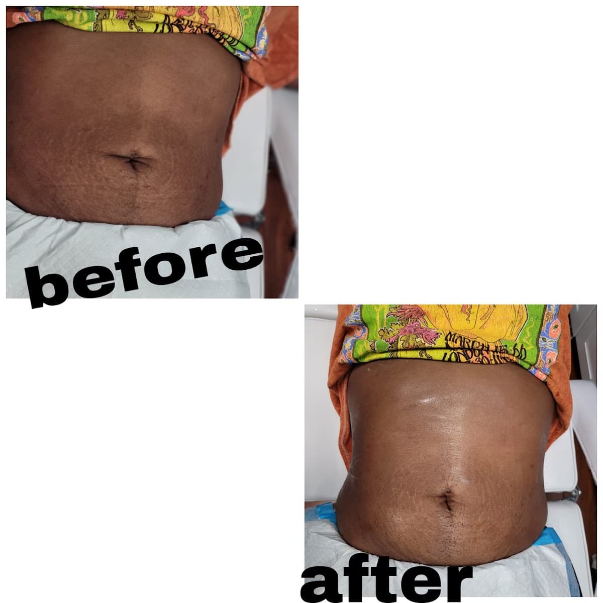 Blissful Glow Spa & Wellness