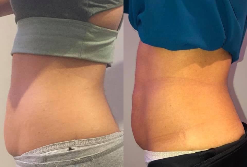 Cryo You (Spearfish)
