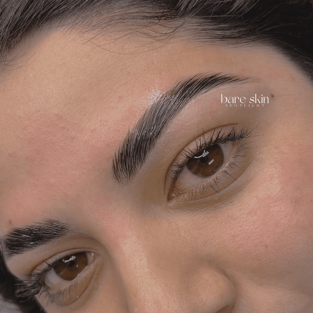 Bare Skin Spotlight photo 1 of 8