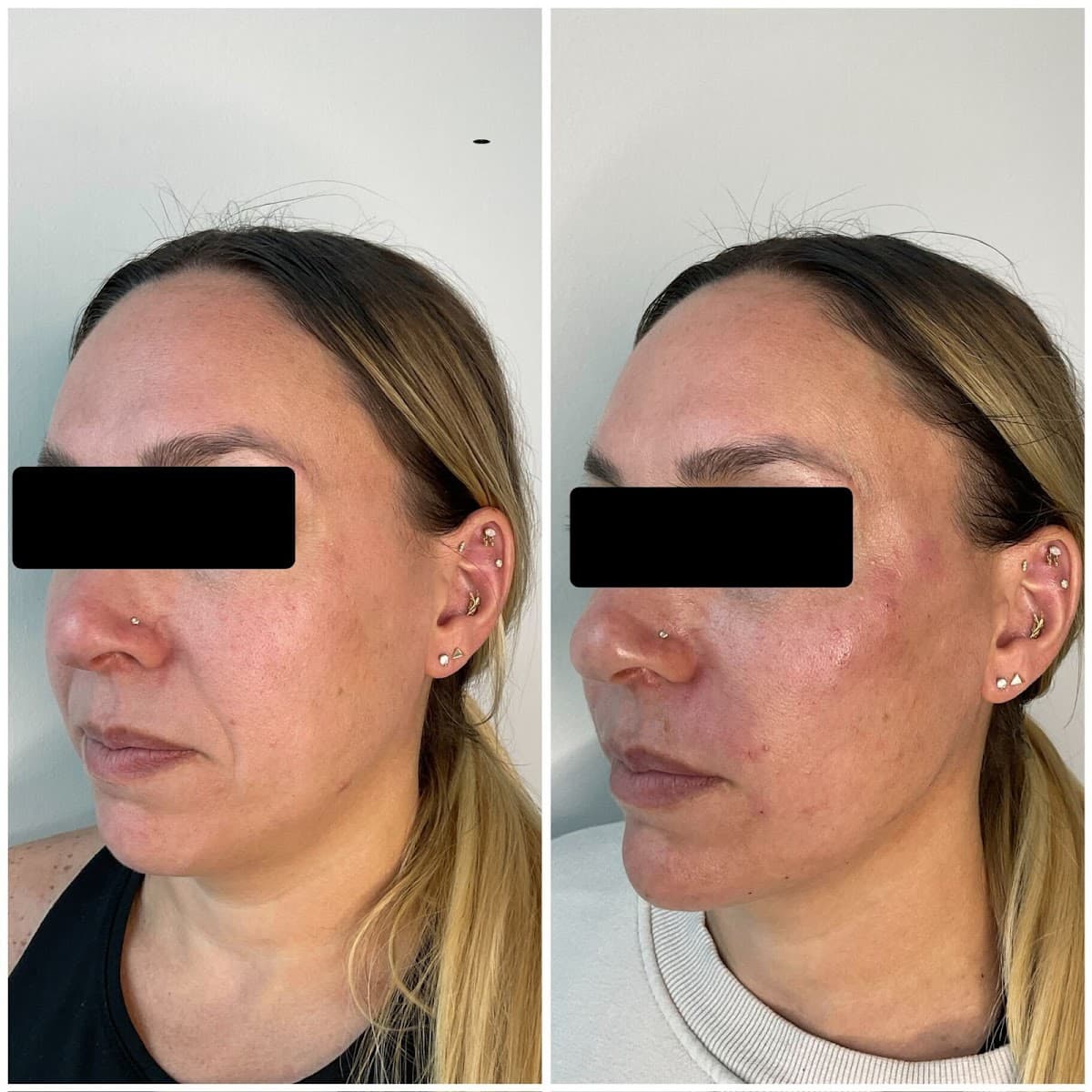 Aspire Medical Spa - RiNo photo 1 of 6
