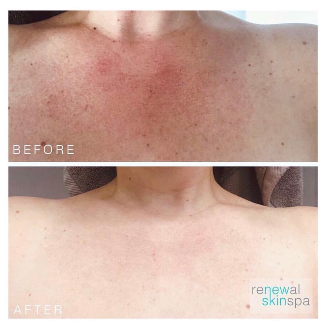 Renewal Skin Spa