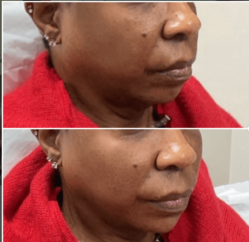 Transformations Weight Loss & Aesthetics photo 1 of 7