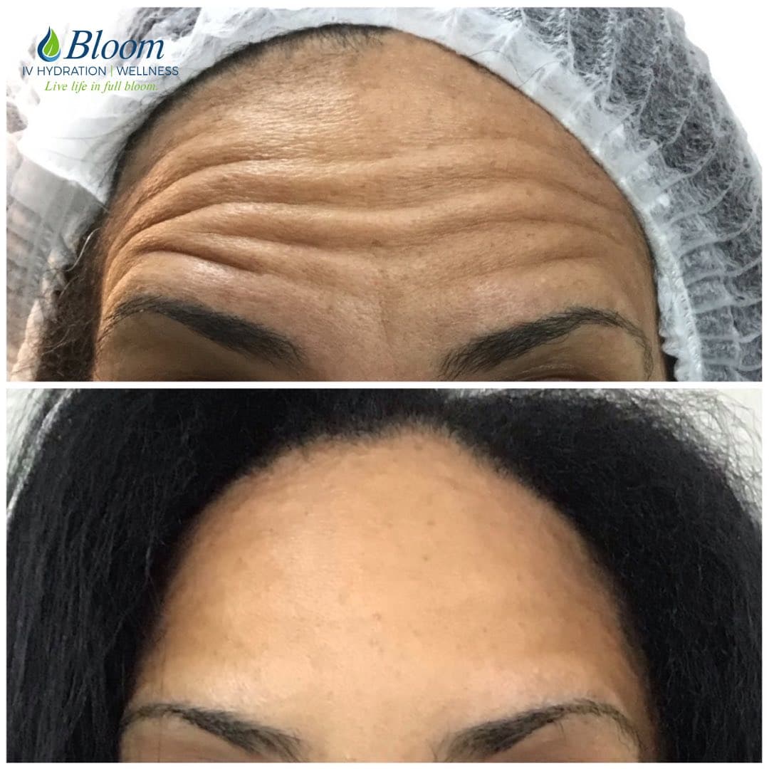 Bloom IV Hydration & Wellness