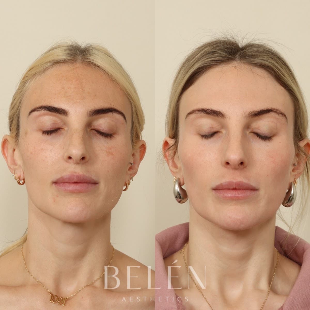 Belén Aesthetics by Hillary Ching and Kendall Peterson