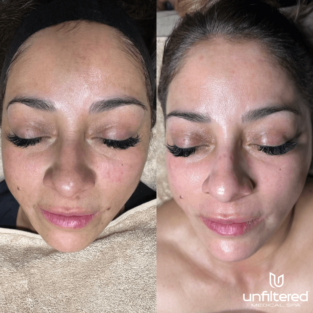 Unfiltered Medical Spa