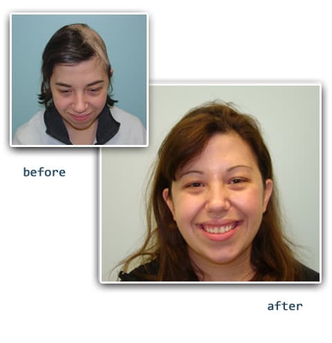 Hair Restoration Center of Connecticut