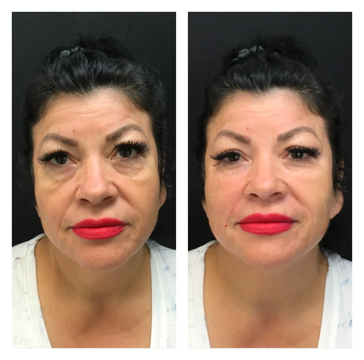 Glo Medspa