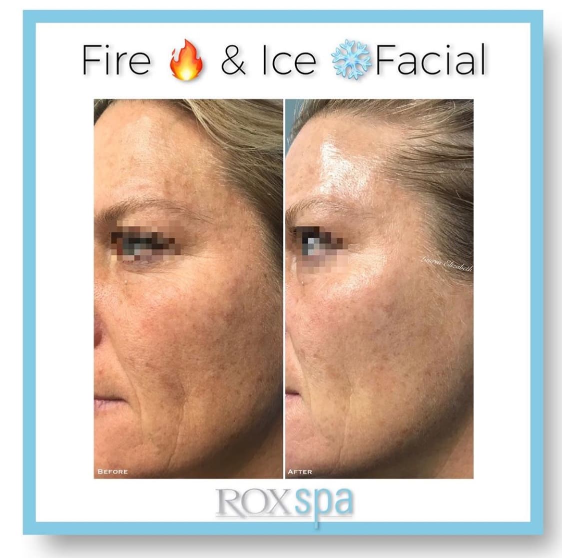 Rox Spa Newport Beach photo 1 of 5
