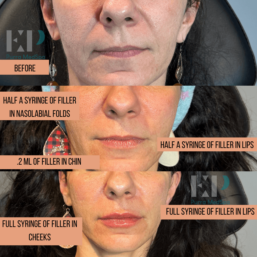Purra MedSpa photo 1 of 8