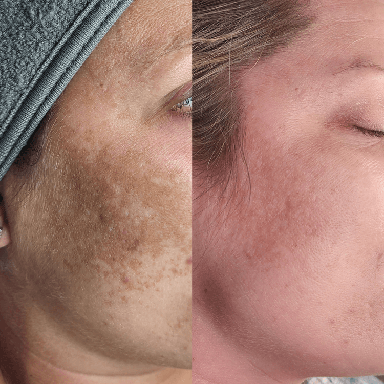 Esthetics With Me - Facial & Waxing Spa