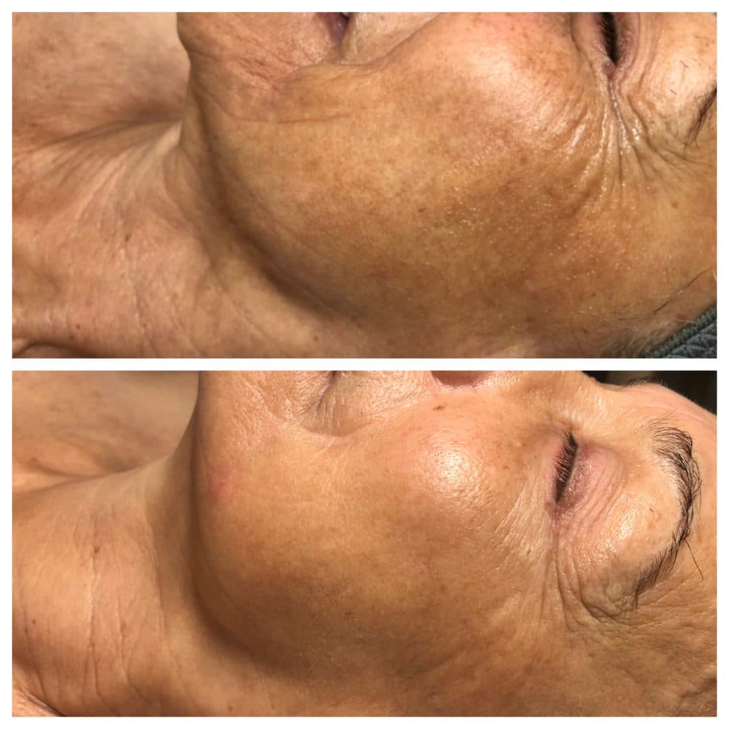 Skin Secrets Fort Lauderdale