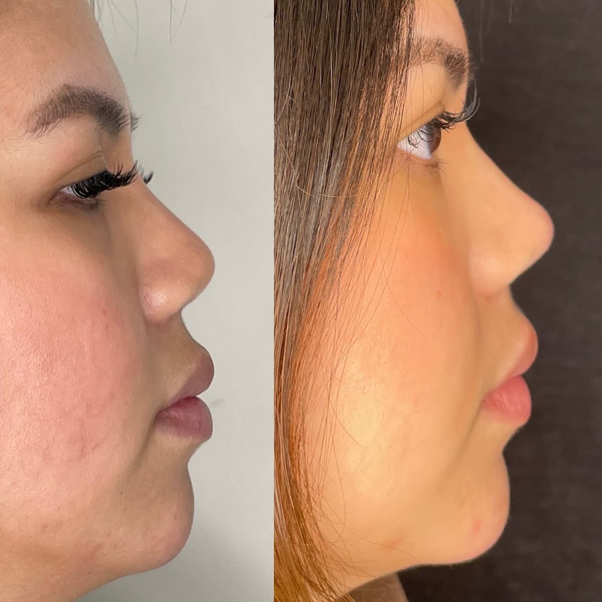 Skinovate Med Spa