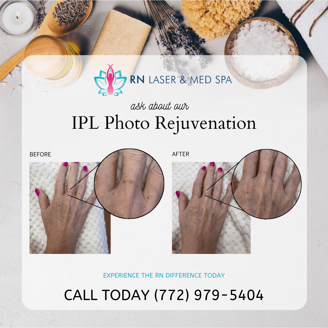 RN Laser & Med Spa