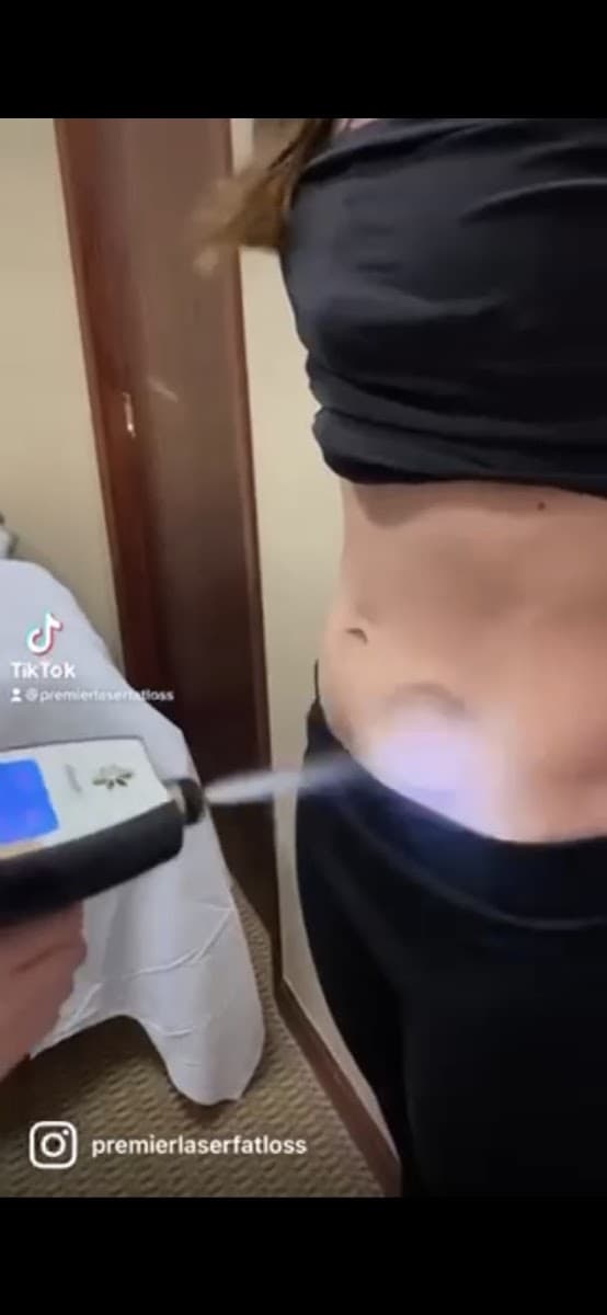 Premier Laser Fat Loss Centers Westminster